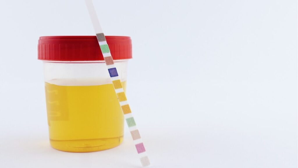 urina espumosa sinal de doença renal