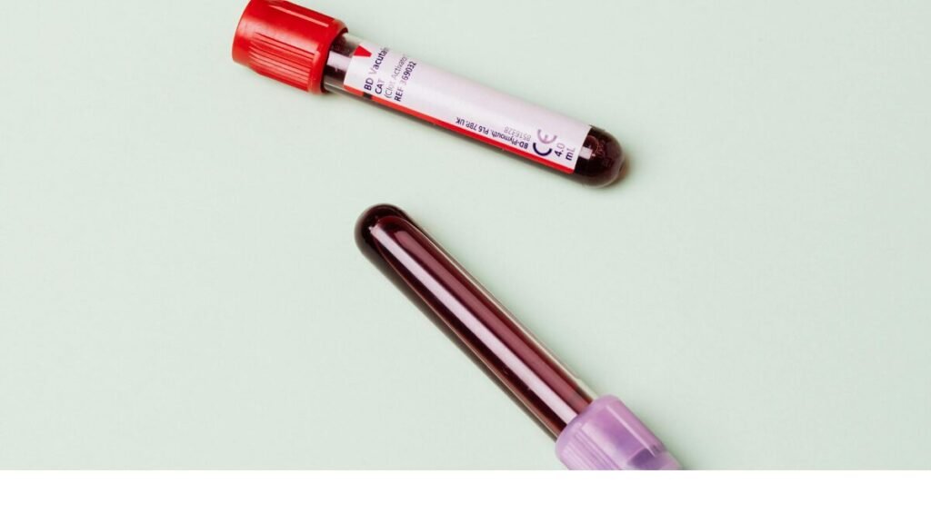 creatinina alta sintomas